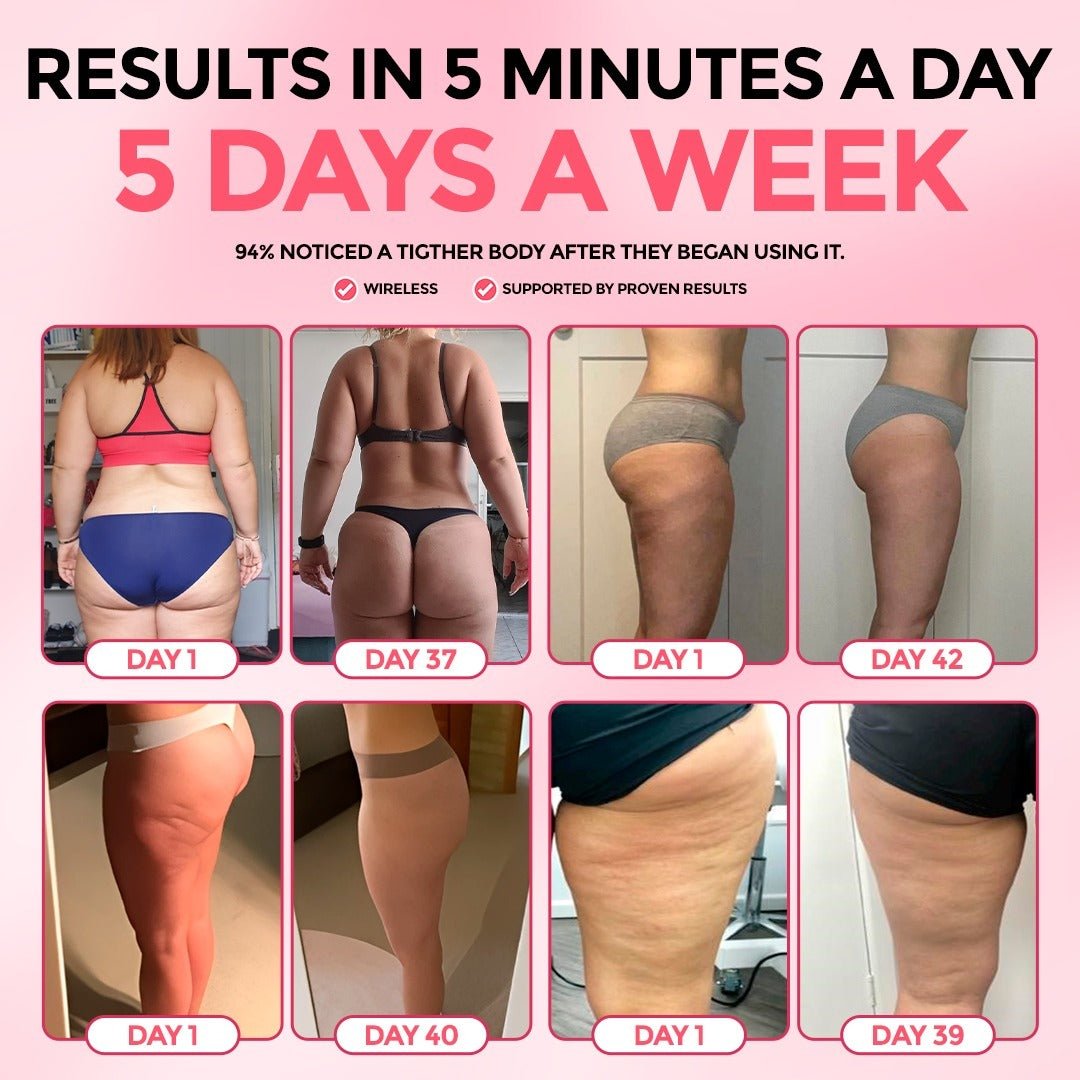 SheVitality™  Cellulite Relief Kit (75% OFF Today)