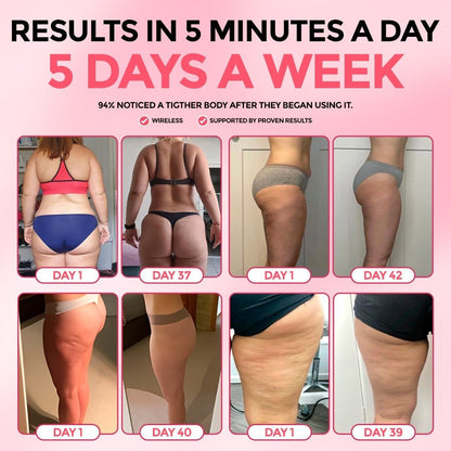 SheVitality™  Cellulite Relief Ultimate Kit
