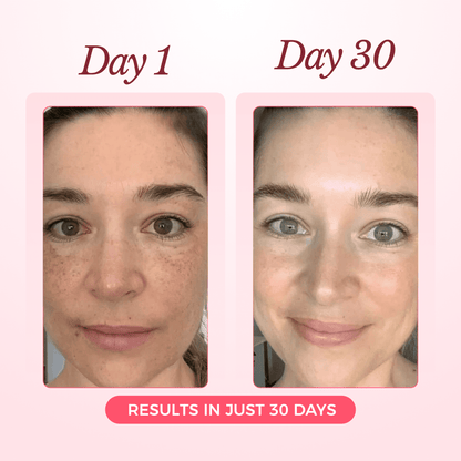 Luxury Collagen Glow Up Mask 2.0 (Spa-Level Results)